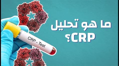 ما هو تحليل C.